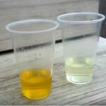 17 Best Homemade/DIY Pregnancy Tests (That Actually Work)